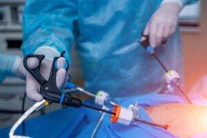 Read more about the article What are the Benefits of laparoscopy?